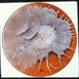 Posterior Uveitis